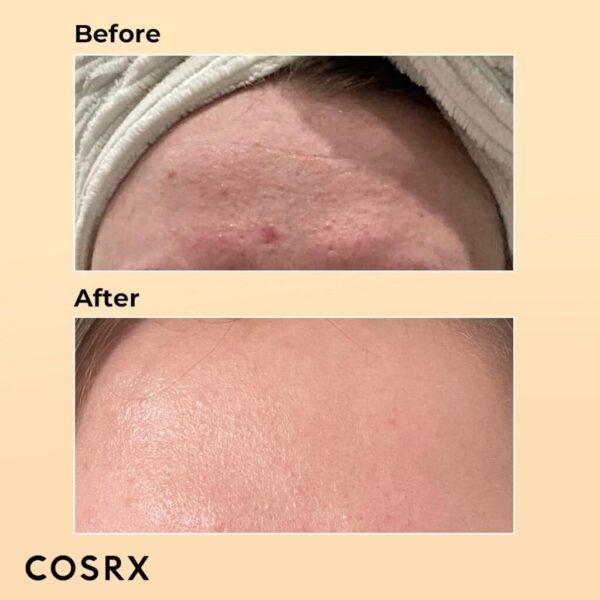 COSRX Advanced Snail 96 Mucin Power Essence 100ml, Skin Repair & Hydrating Serum - Image 2